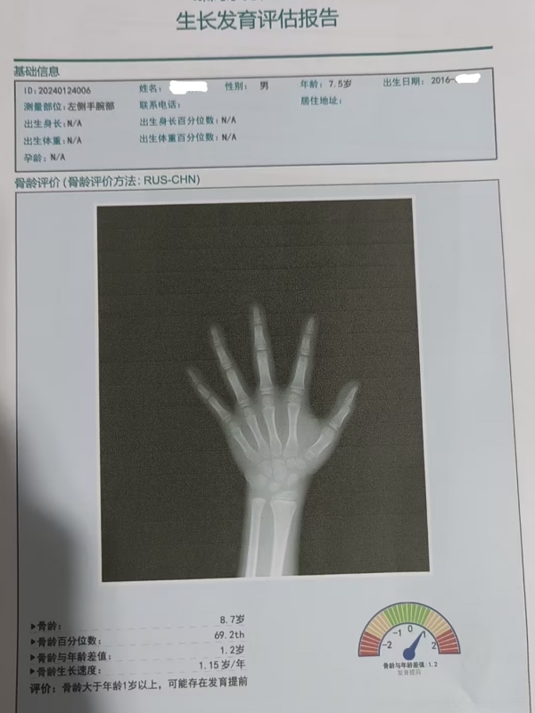 骨龄和身高有什么关系？每个孩子都有必要检测吗？